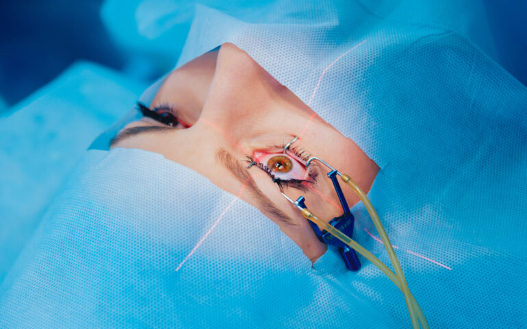 Laser,Vision,Correction.,A,Patient,And,Team,Of,Surgeons,In